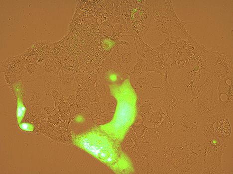 Quantification of general ROS activity