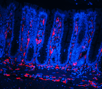 Visualization of infiltrating macrophages in the colon 