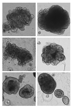 colorectal cancer organoid lines