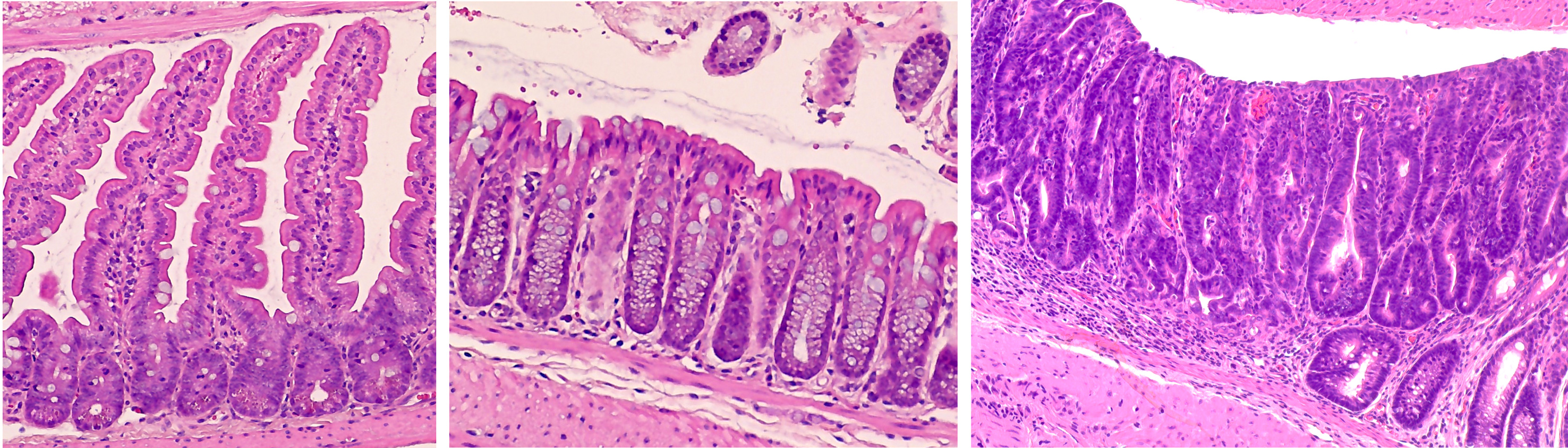 Hematoxylin and eosin staining